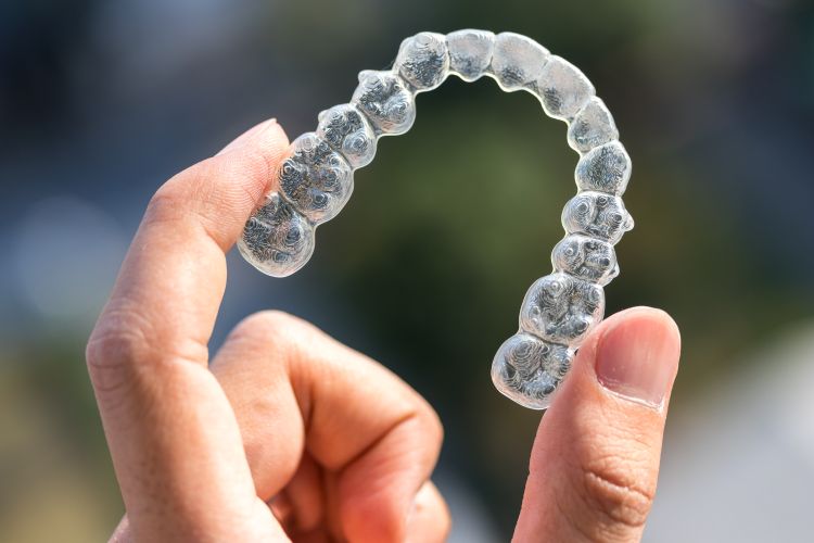 Clear Aligner Therapy In Vancouver